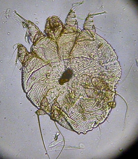You are currently viewing Scabies, Itch Mites or Short-Legged Mites